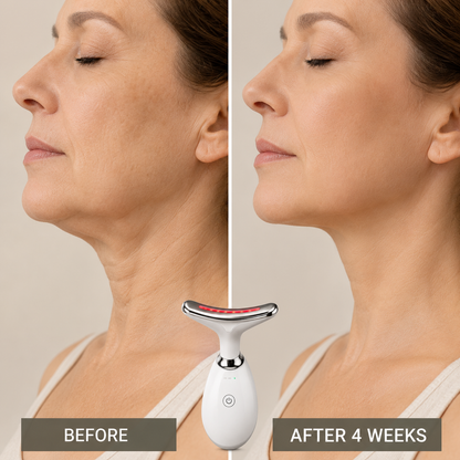 GlowLift™ - 3’ü 1 Arada LED Terapi & Yüz Sıkılaştırma Cihazı (+ C-Serum Hediye)